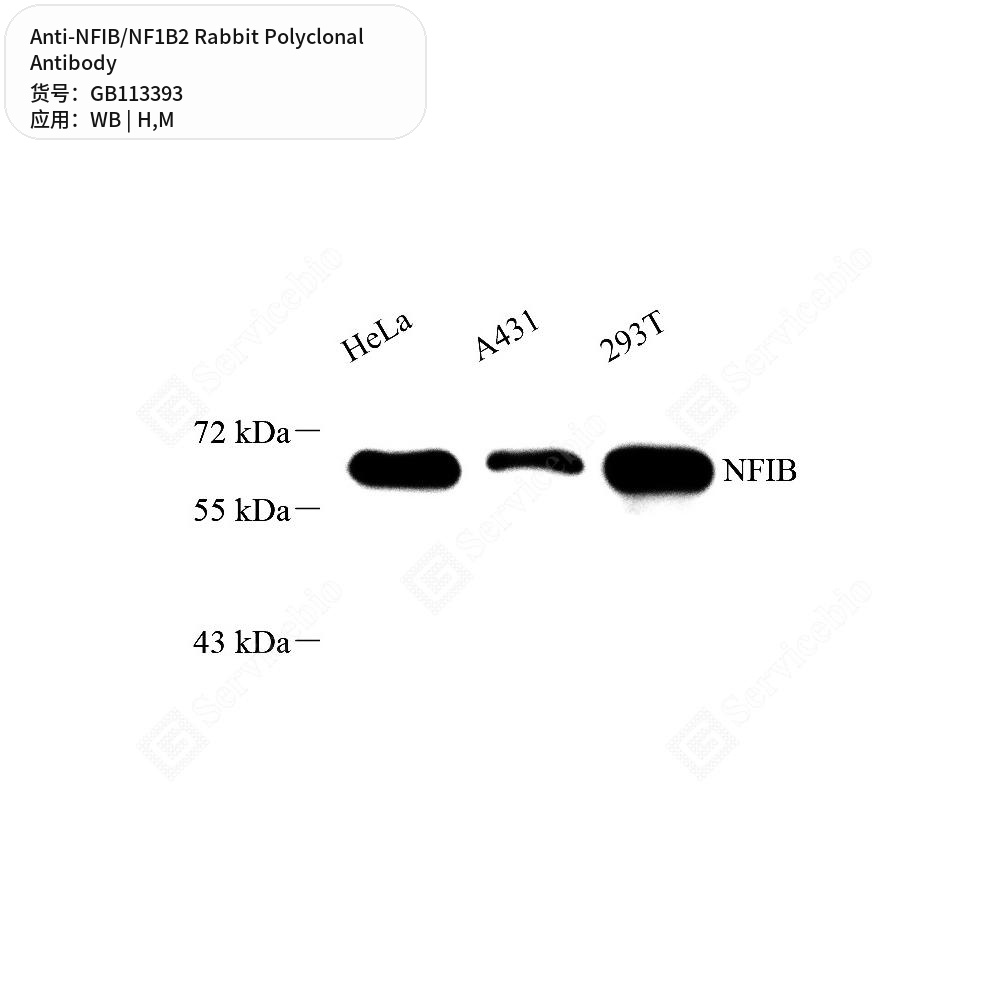 Антитела первичные, поликлональные кролика к NFIB/NF1B2 мыши, человека, 50 мкл