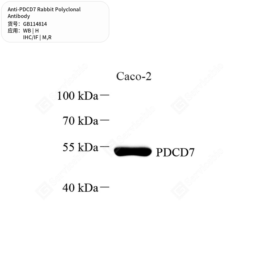 Антитела первичные, поликлональные кролика к PDCD7 крысы, мыши, человека, 50 мкл