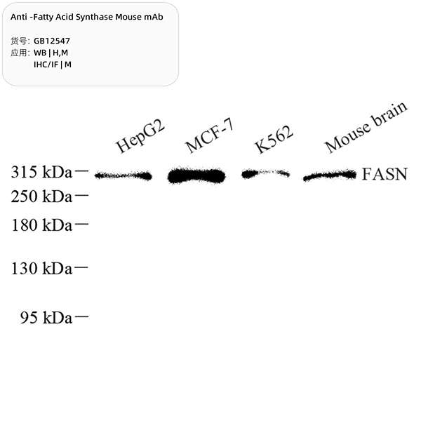 Антитела первичные, моноклональные, Fatty Acid Synthase, 100 мкл