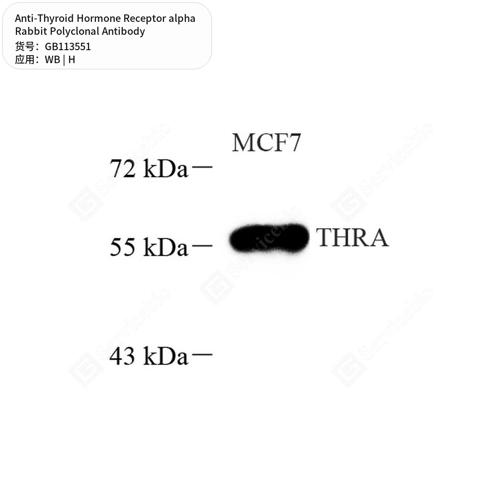 Антитела первичные, поликлональные кролика к Thyroid Hormone Receptor alpha человека, 50 мкл