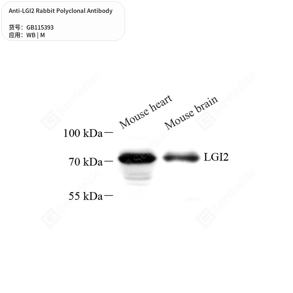 Антитела первичные, поликлональные кролика к LGI2 мыши, 50 мкл