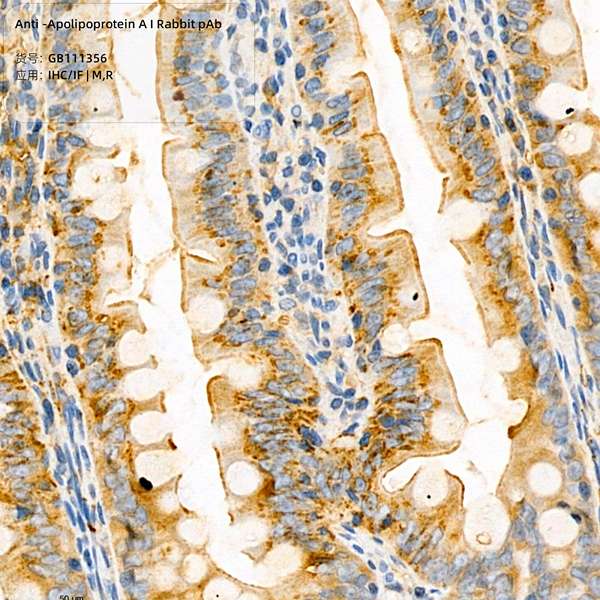 Антитела первичные, поликлональные, Apolipoprotein A I, 100 мкл