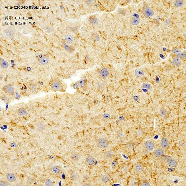 Антитела первичные, поликлональные, C2CD4D, 100 мкл