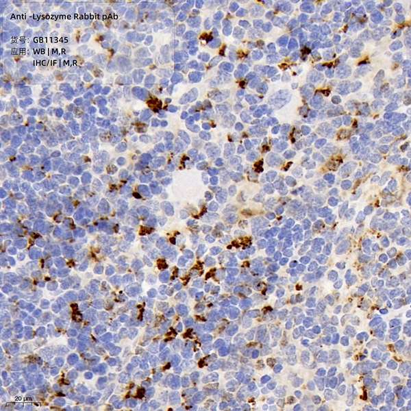 Антитела первичные, поликлональные, Lysozyme, 100 мкл