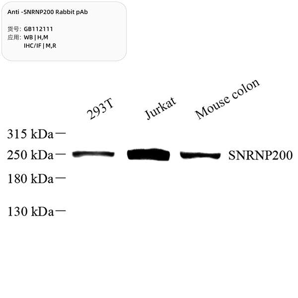 Антитела первичные, поликлональные, SNRNP200, 100 мкл