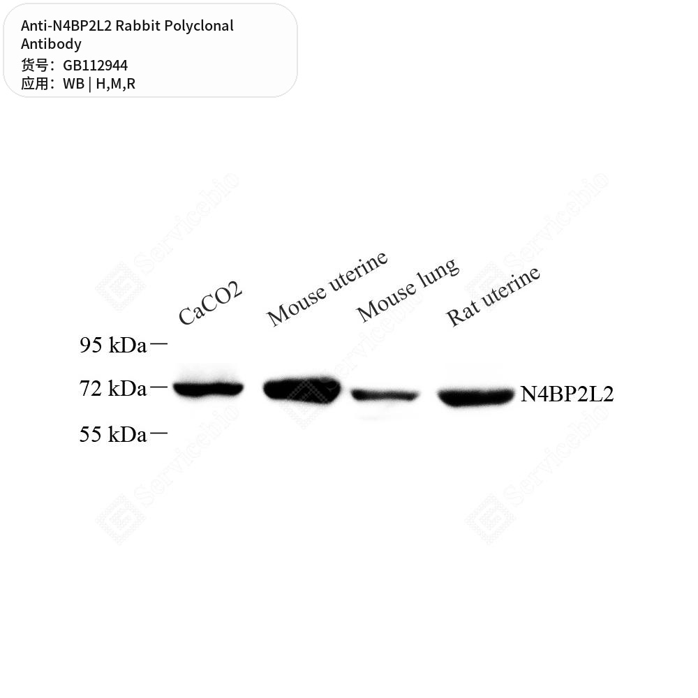 Антитела первичные, поликлональные кролика к N4BP2L2 крысы, мыши, человека, 50 мкл