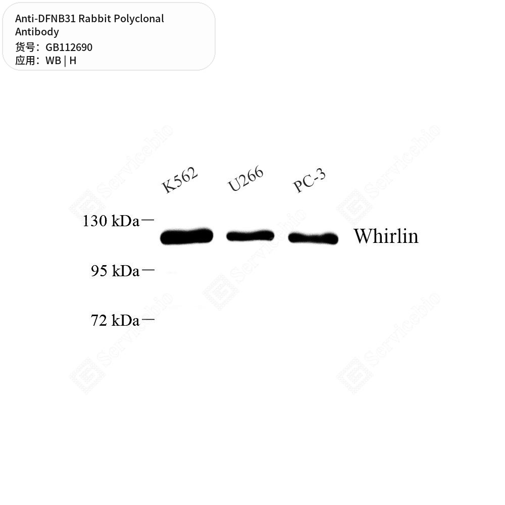 Антитела первичные, поликлональные кролика к DFNB31 человека, 100 мкл