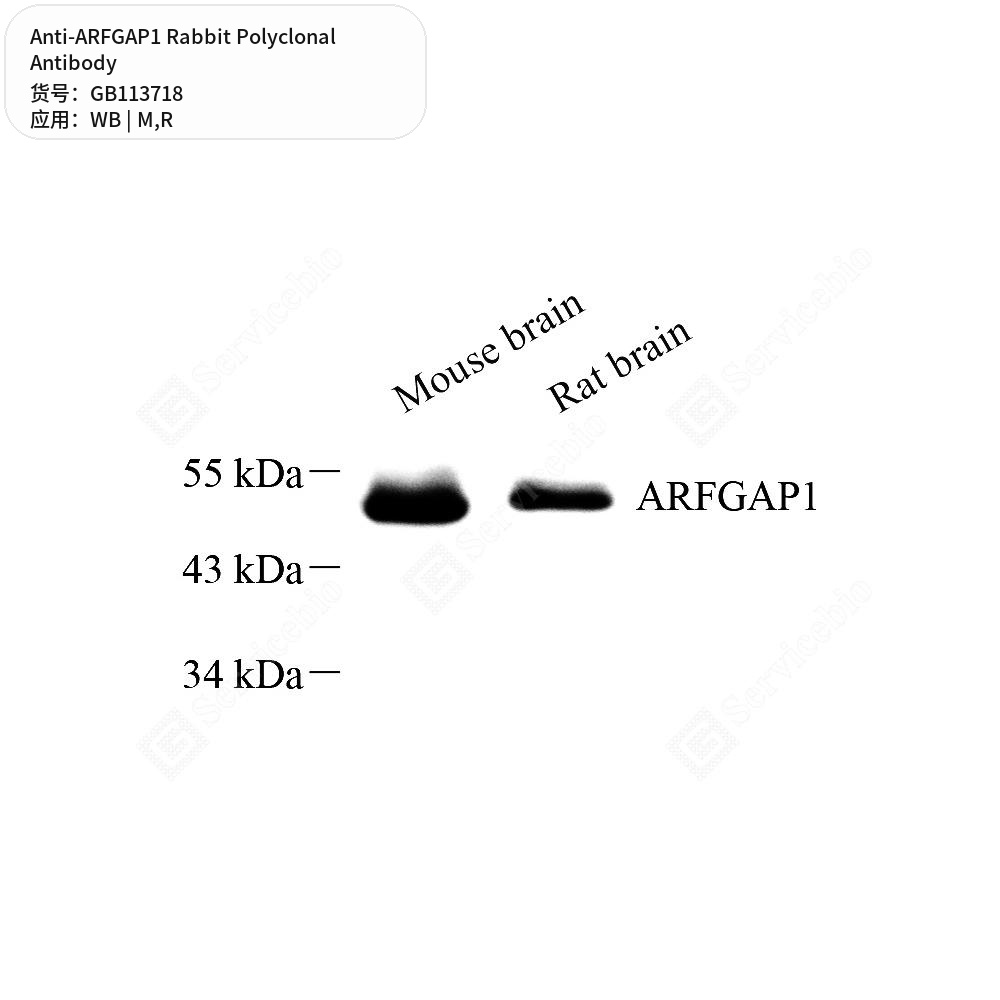 Антитела первичные, поликлональные кролика к ARFGAP1 крысы, мыши, 50 мкл