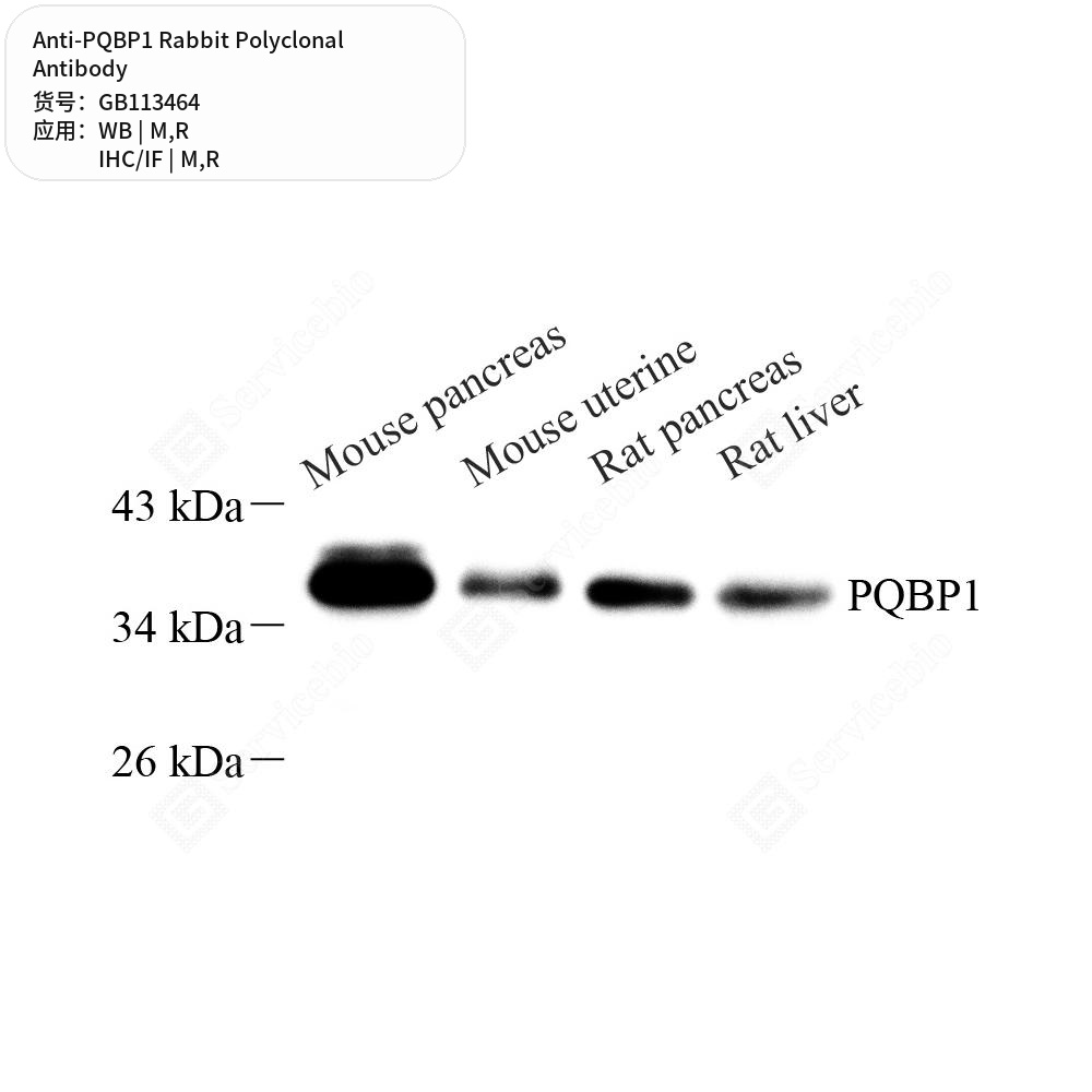 Антитела первичные, поликлональные кролика к PQBP1 крысы, мыши, 50 мкл