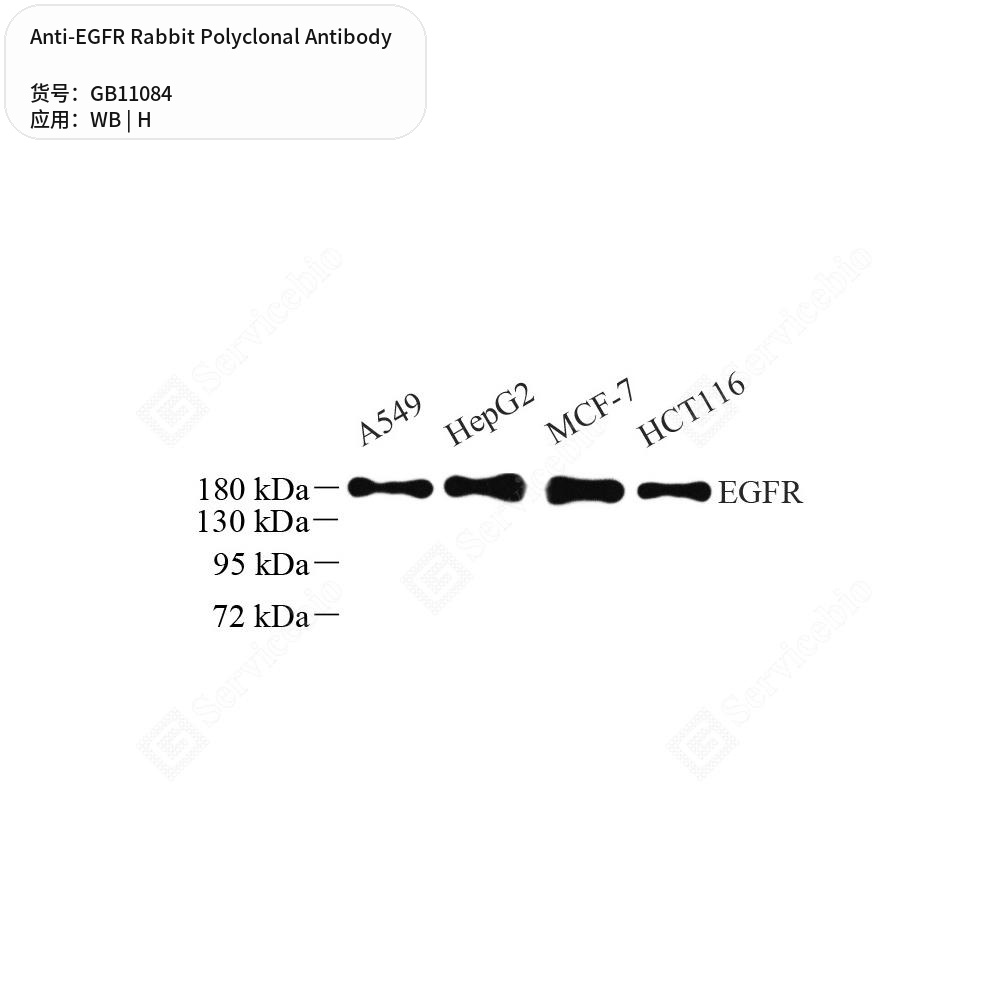 Антитела первичные, поликлональные кролика к EGFR человека, 100 мкл