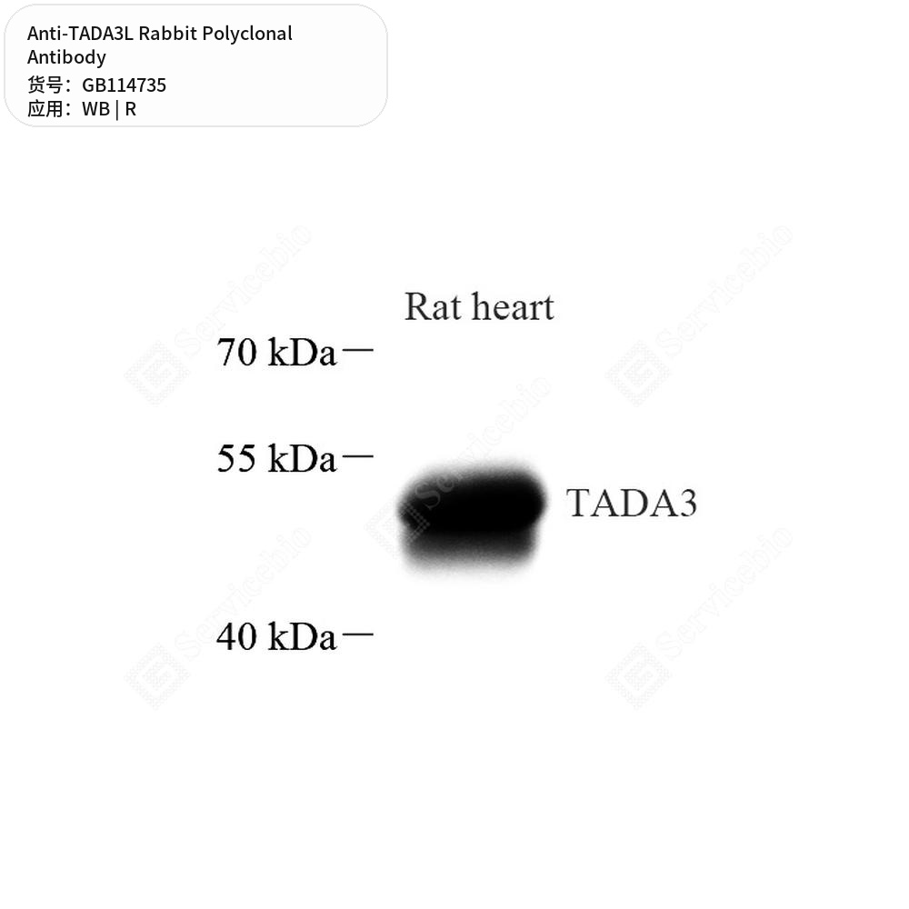 Антитела первичные, поликлональные кролика к TADA3L крысы, 100 мкл