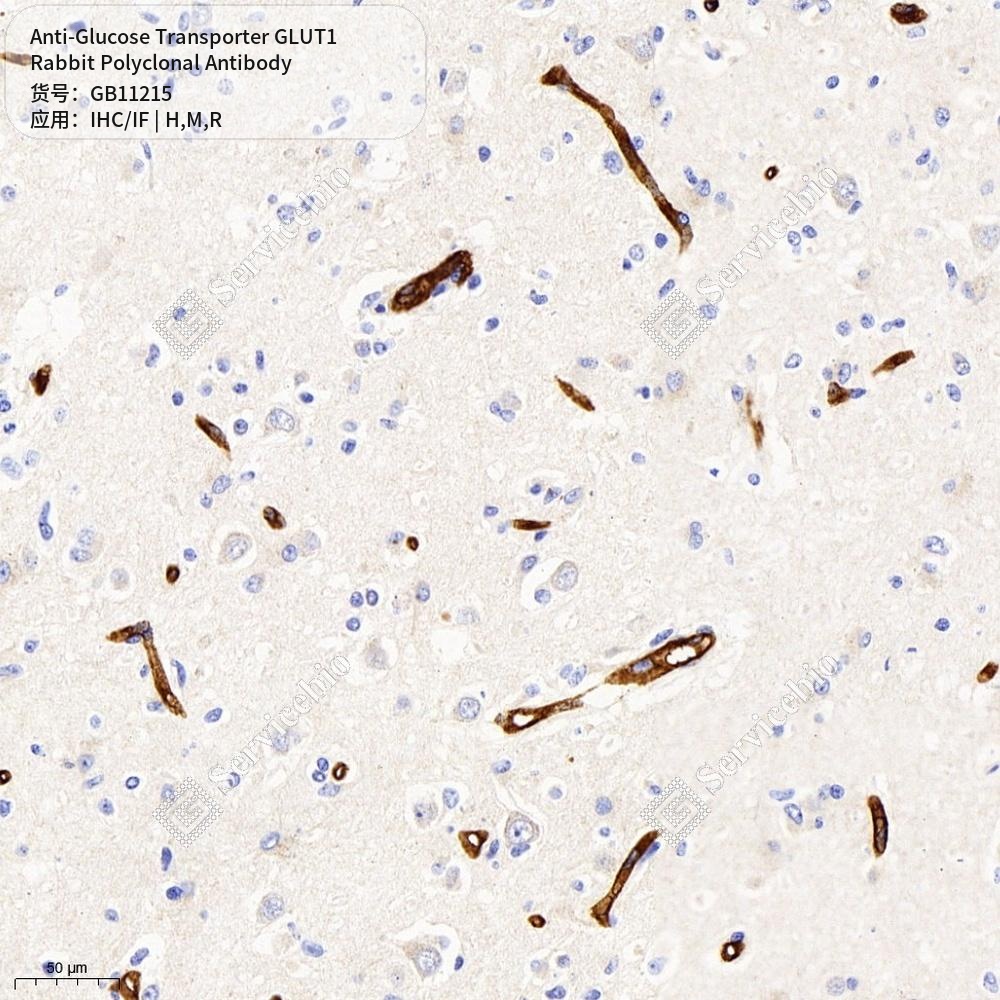 Антитела первичные, поликл. кролика к Glucose Transporter GLUT1 крысы, мыши, человека, 100 мкл