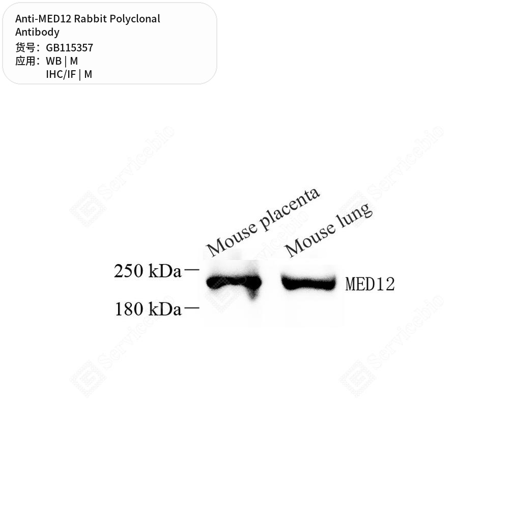Антитела первичные, поликлональные кролика к MED12 мыши, 100 мкл