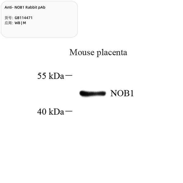 Антитела первичные, поликлональные, NOB1, 100 мкл