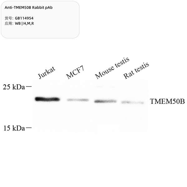Антитела первичные, поликлональные, TMEM50B, 100 мкл