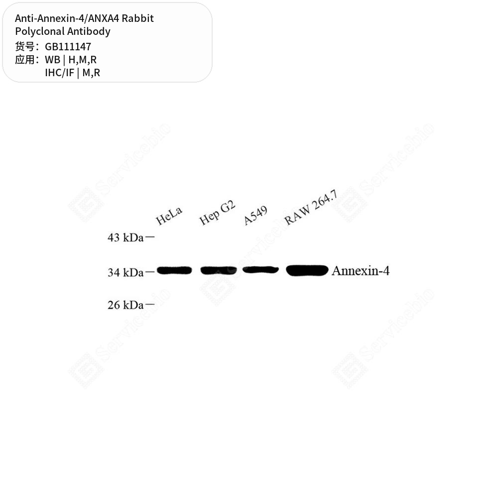 Антитела первичные, поликлональные кролика к Annexin-4/ANXA4 крысы, мыши, человека, 100 мкл