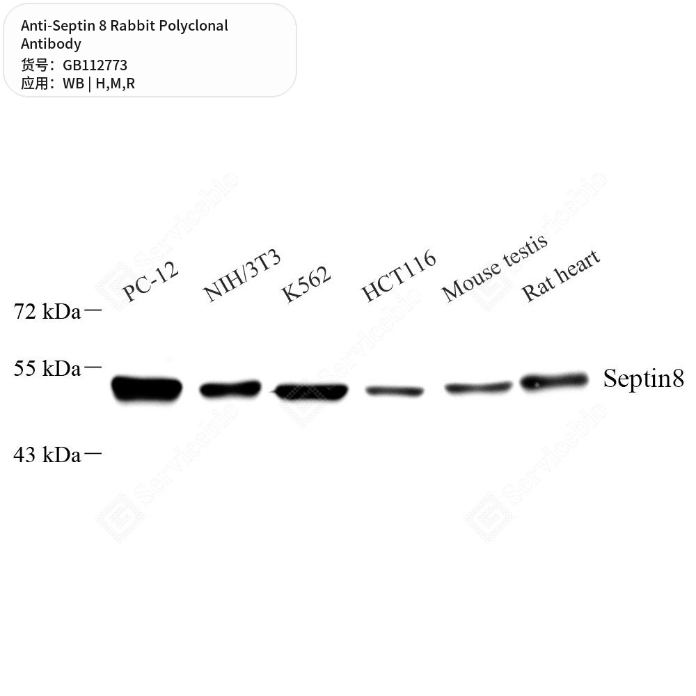 Антитела первичные, поликлональные кролика к Septin 8 крысы, мыши, человека, 50 мкл