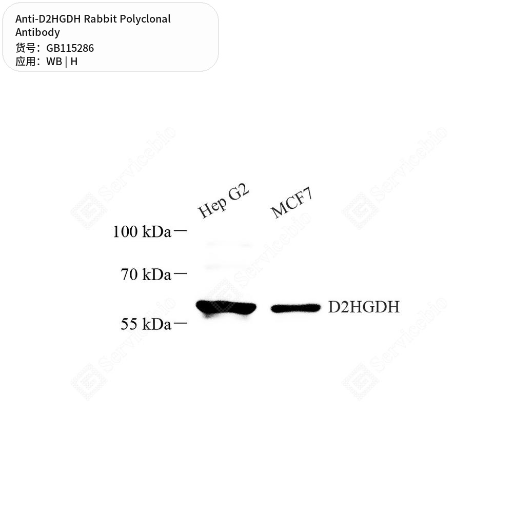 Антитела первичные, поликлональные кролика к D2HGDH человека, 50 мкл
