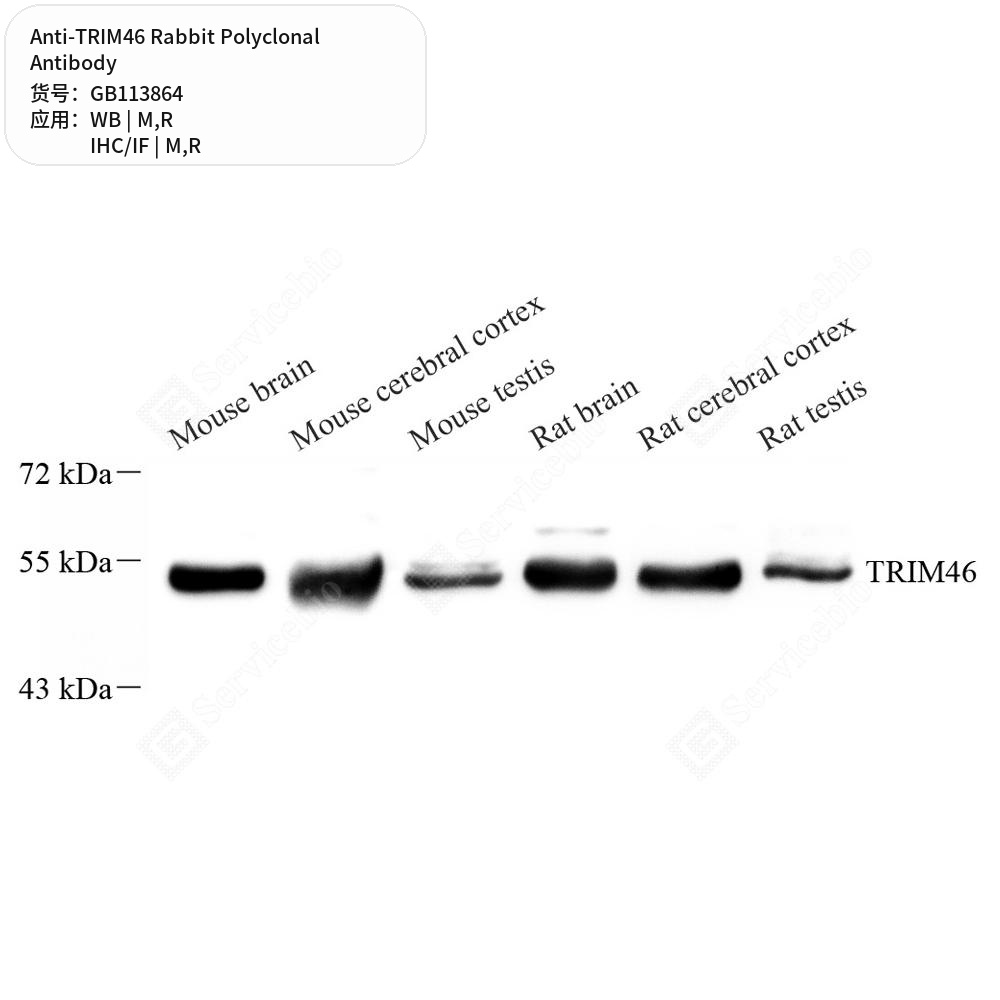 Антитела первичные, поликлональные кролика к TRIM46 крысы, мыши, 50 мкл