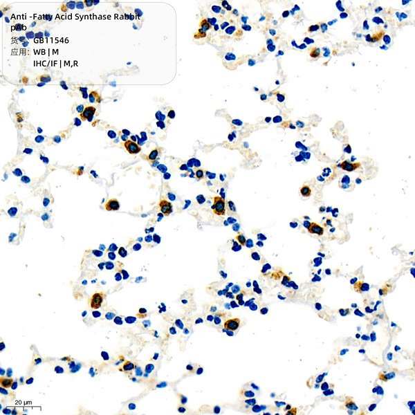 Антитела первичные, поликлональные, Fatty Acid Synthase, 100 мкл