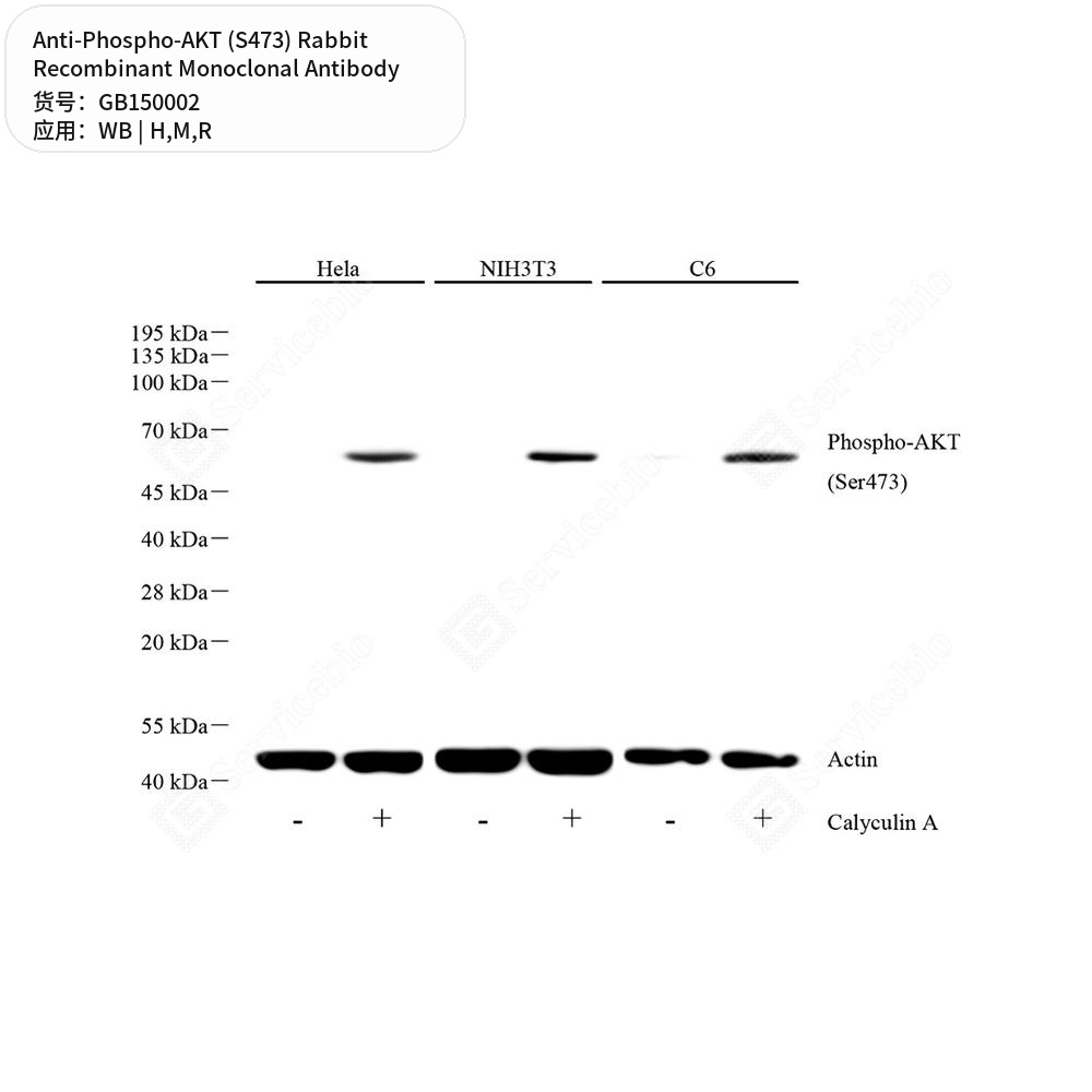 Антитела первичные, моноклональные кролика к Phospho-AKT (S473) крысы, мыши, человека, 50 мкл
