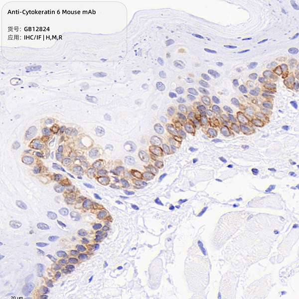 Антитела первичные, моноклональные, Cytokeratin 6, 100 мкл