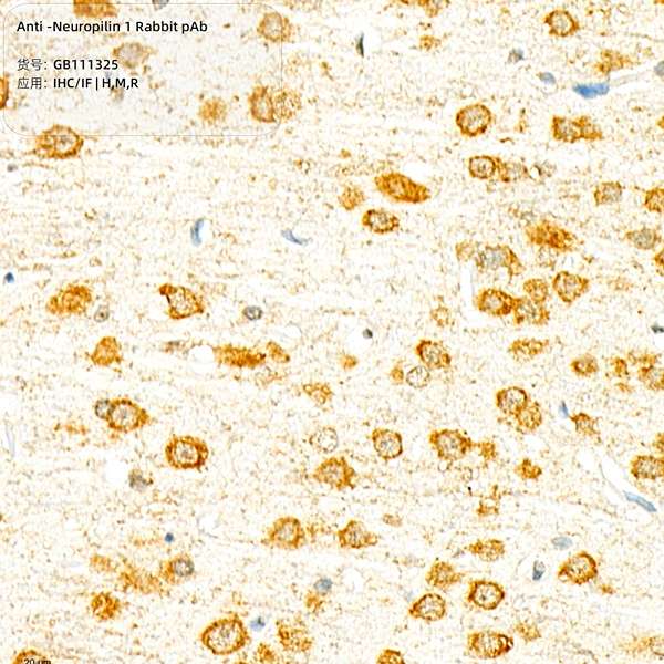 Антитела первичные, поликлональные, Neuropilin 1, 100 мкл