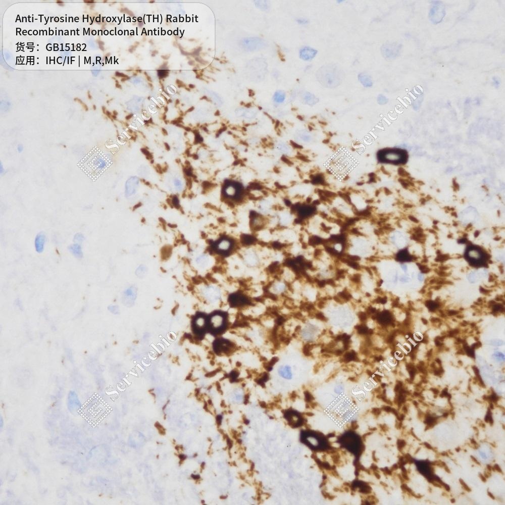 Антитела первичные, моноклональные крол. к Tyrosine Hydroxylase(TH) крысы, мыши, обезьяны, 100 мкл