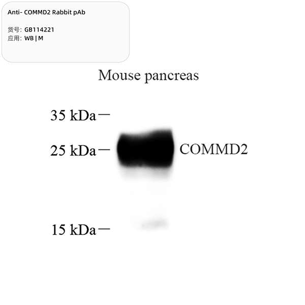 Антитела первичные, поликлональные, COMMD2, 100 мкл