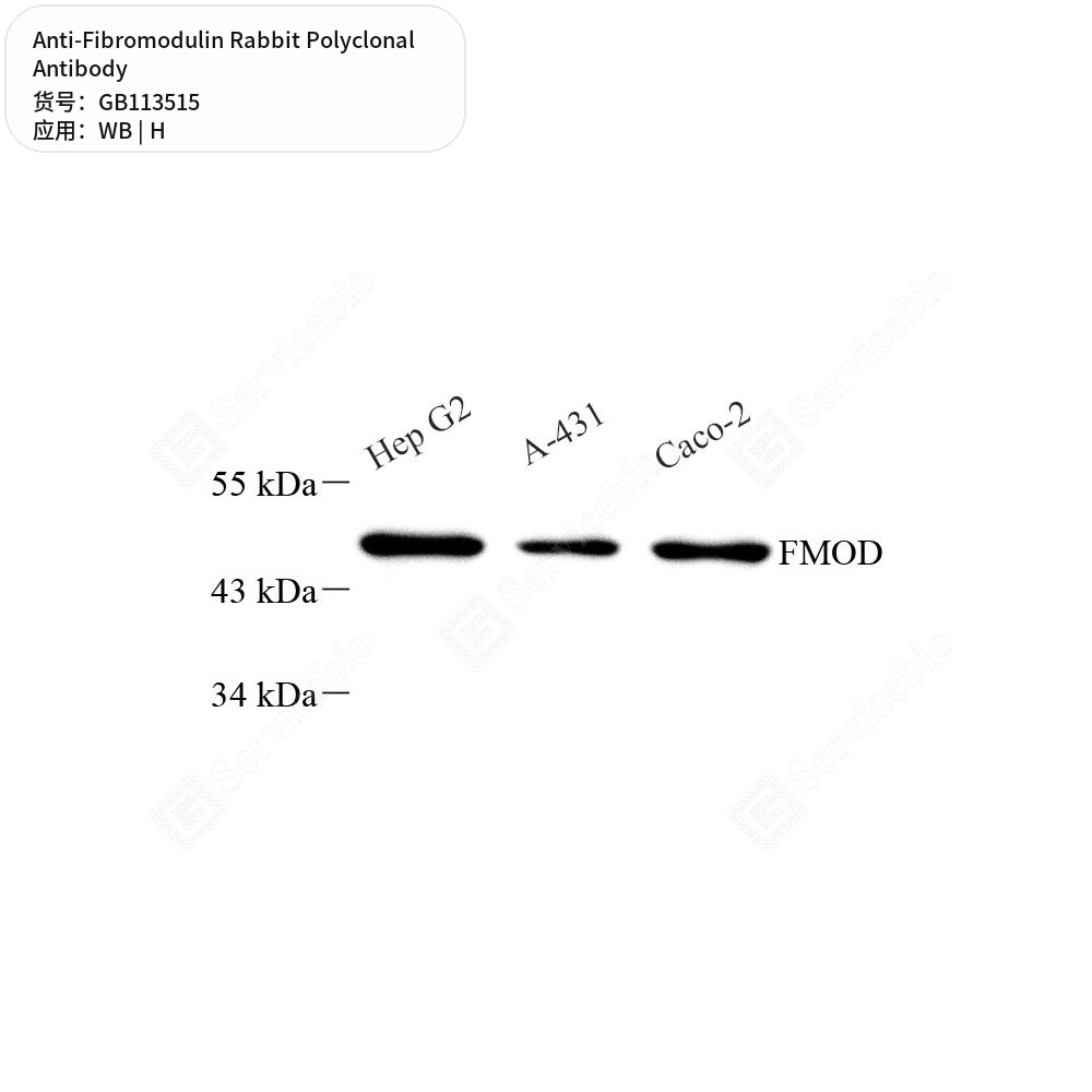 Антитела первичные, поликлональные кролика к Fibromodulin человека, 50 мкл