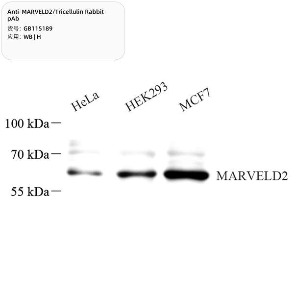 Антитела первичные, поликлональные, MARVELD2/Tricellulin, 100 мкл
