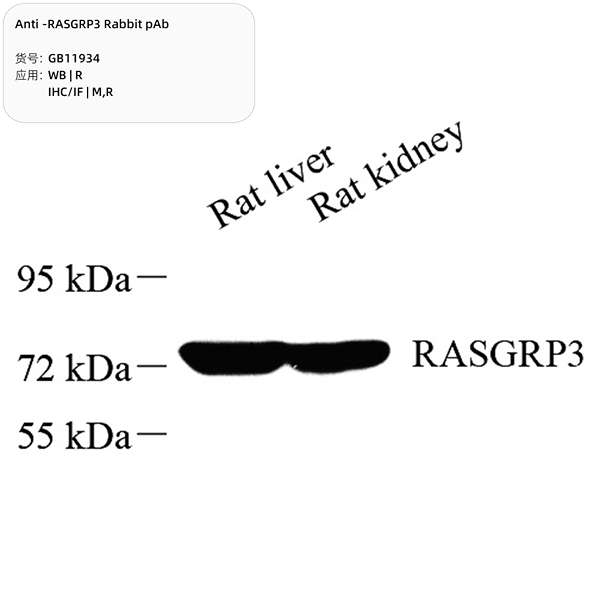 Антитела первичные, поликлональные, RASGRP3, 100 мкл