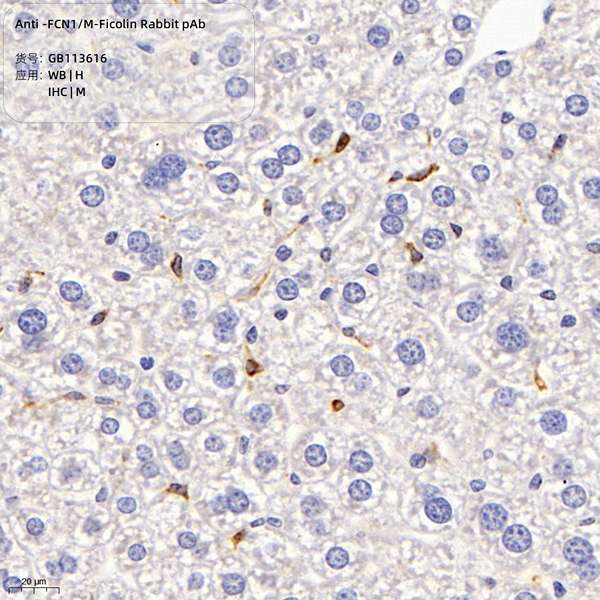 Антитела первичные, поликлональные, FCN1/M-Ficolin, 100 мкл