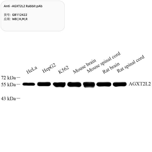 Антитела первичные, поликлональные, AGXT2L2, 100 мкл