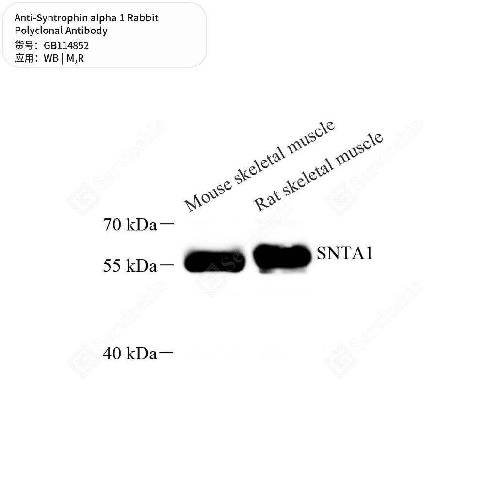 Антитела первичные, поликлональные кролика к Syntrophin alpha 1 крысы, мыши, 50 мкл