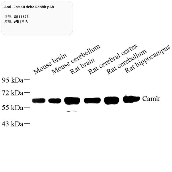Антитела первичные, поликлональные, CaMKII delta, 100 мкл