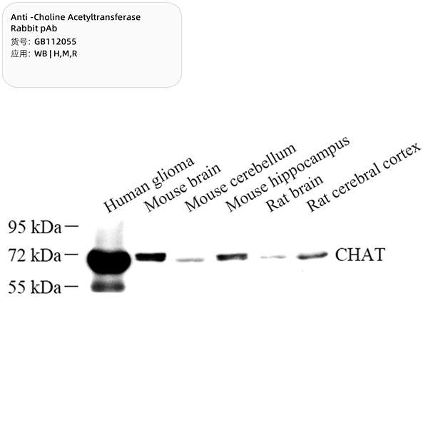 Антитела первичные, поликлональные, Choline Acetyltransferase, 100 мкл