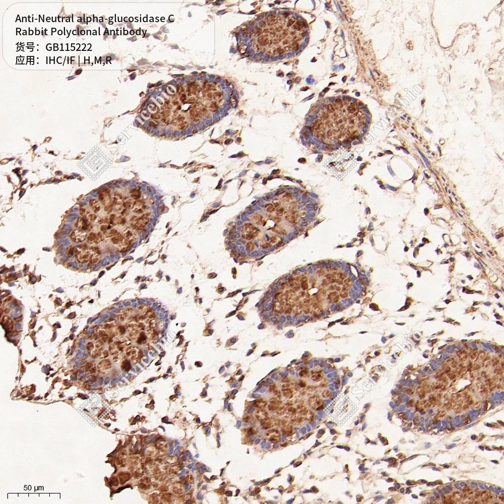 Антитела первичные, поликл. кролика к Neutral alpha-glucosidase C крысы, мыши, человека, 50 мкл