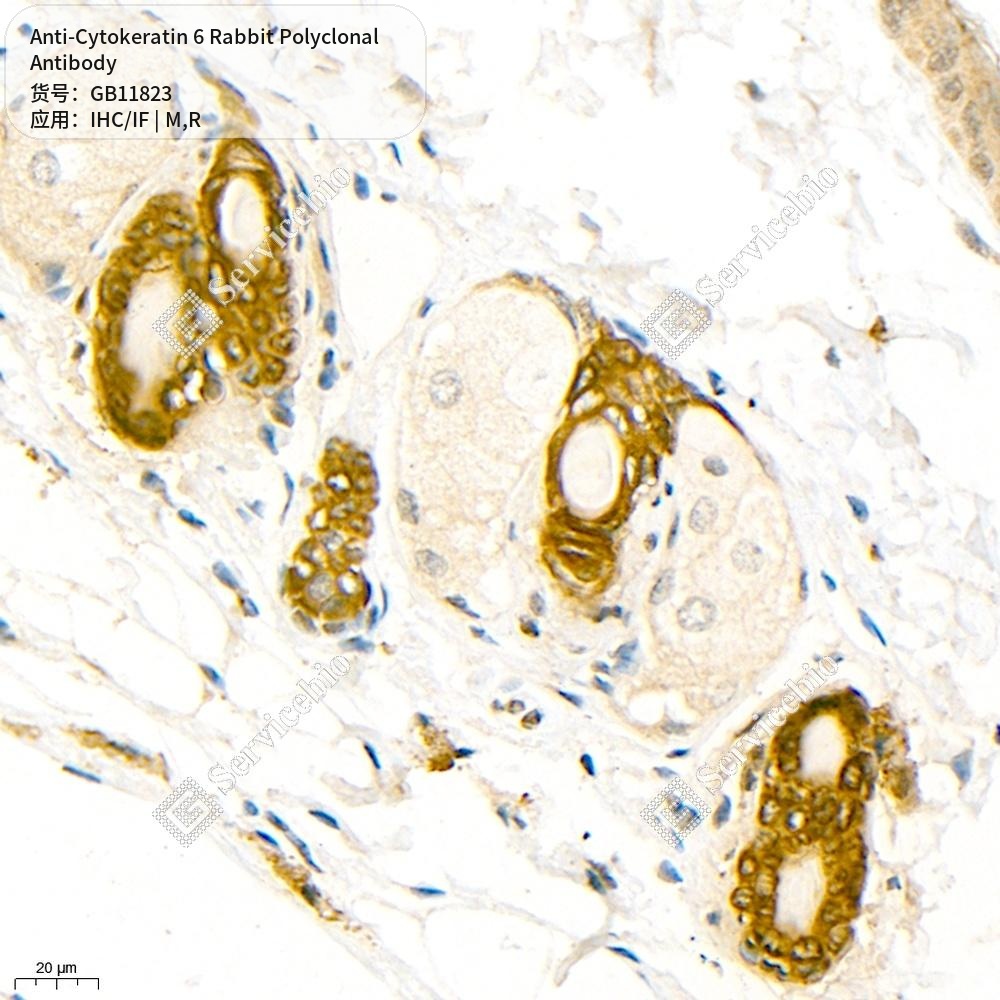 Антитела первичные, поликлональные кролика к Cytokeratin 6 крысы, мыши, 50 мкл