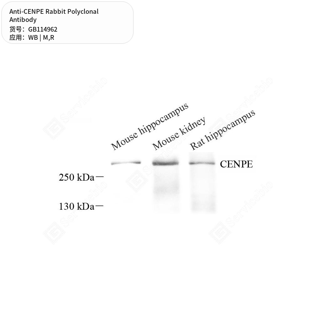 Антитела первичные, поликлональные кролика к CENPE крысы, мыши, 50 мкл