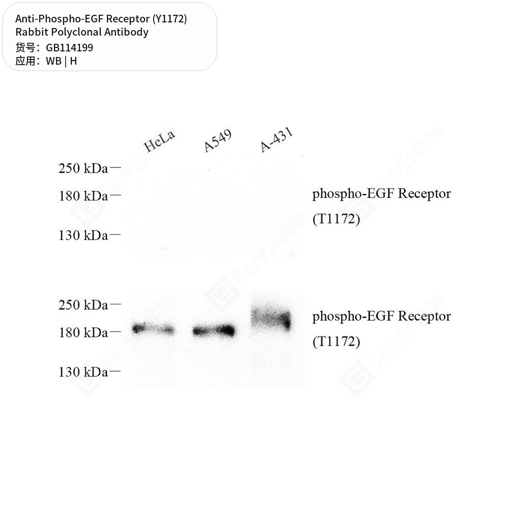 Антитела первичные, поликлональные кролика к Phospho-EGF Receptor (Y1172) человека, 50 мкл