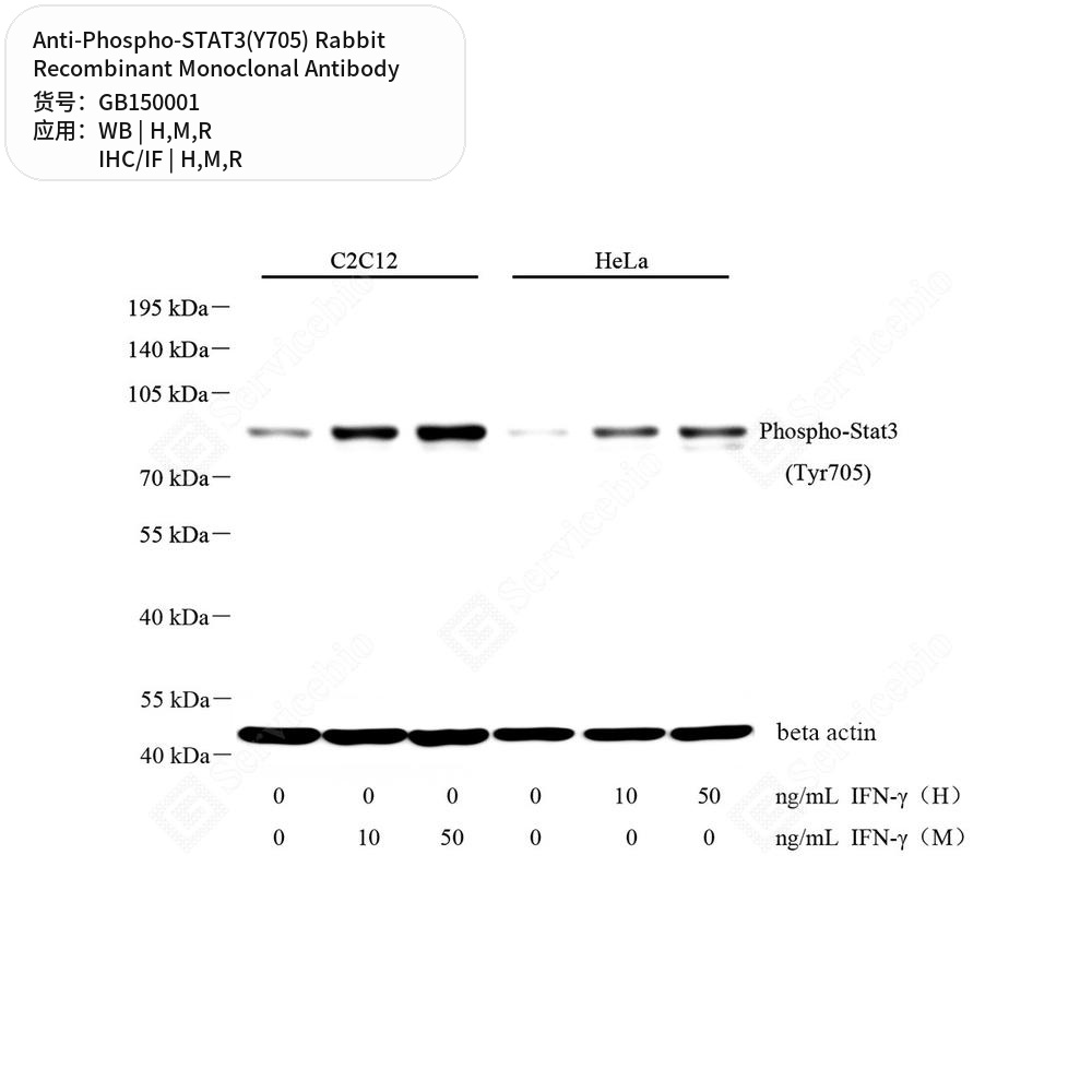Антитела первичные, моноклональные кролика к Phospho-STAT3(Y705) крысы, мыши, человека, 50 мкл