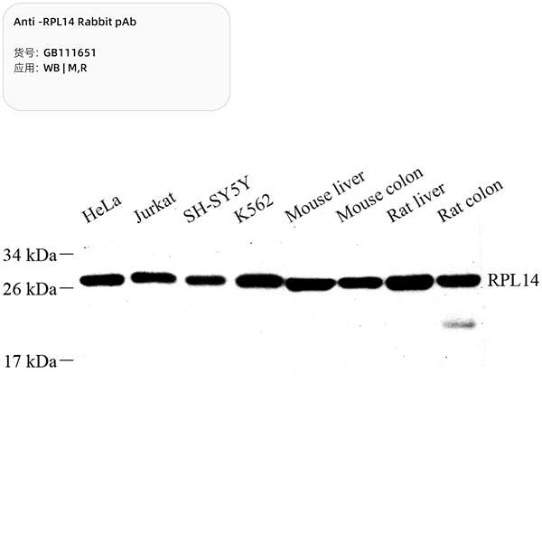 Антитела первичные, поликлональные, RPL14, 100 мкл