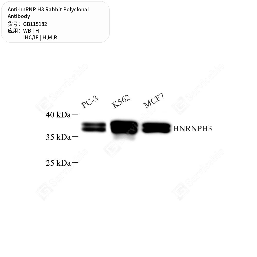 Антитела первичные, поликлональные кролика к hnRNP H3 крысы, мыши, человека, 50 мкл
