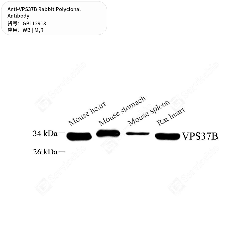 Антитела первичные, поликлональные кролика к VPS37B крысы, мыши, 100 мкл