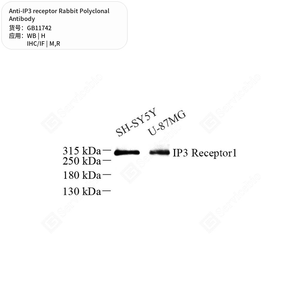 Антитела первичные, поликлональные кролика к IP3 receptor крысы, мыши, человека, 50 мкл