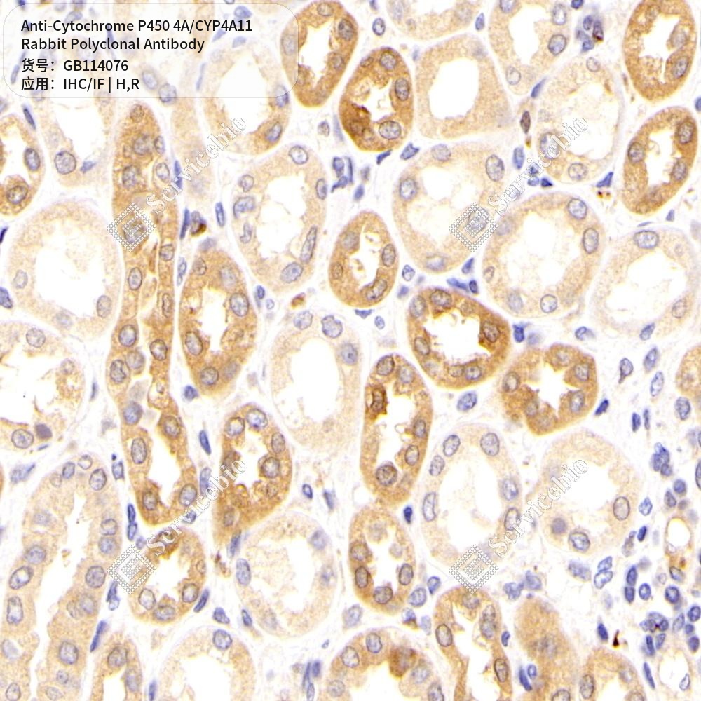 Антитела первичные, поликлональные кролика к Cytochrome P450 4A/CYP4A11 крысы, человека, 50 мкл