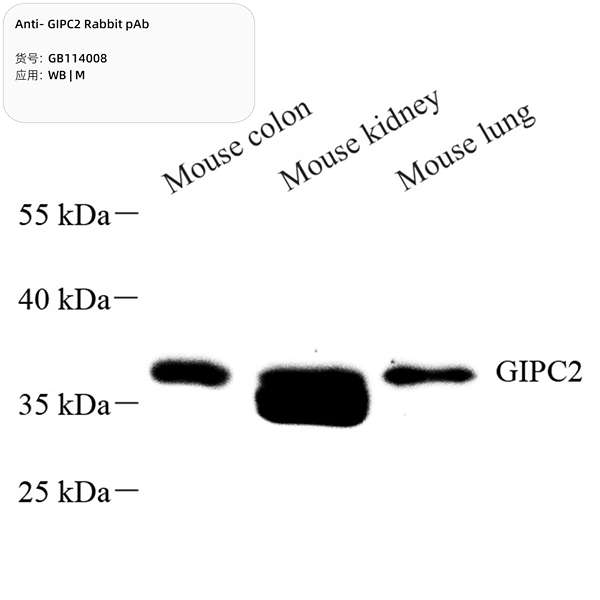 Антитела первичные, поликлональные, GIPC2, 100 мкл