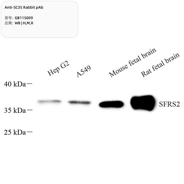 Антитела первичные, поликлональные, SC35, 100 мкл