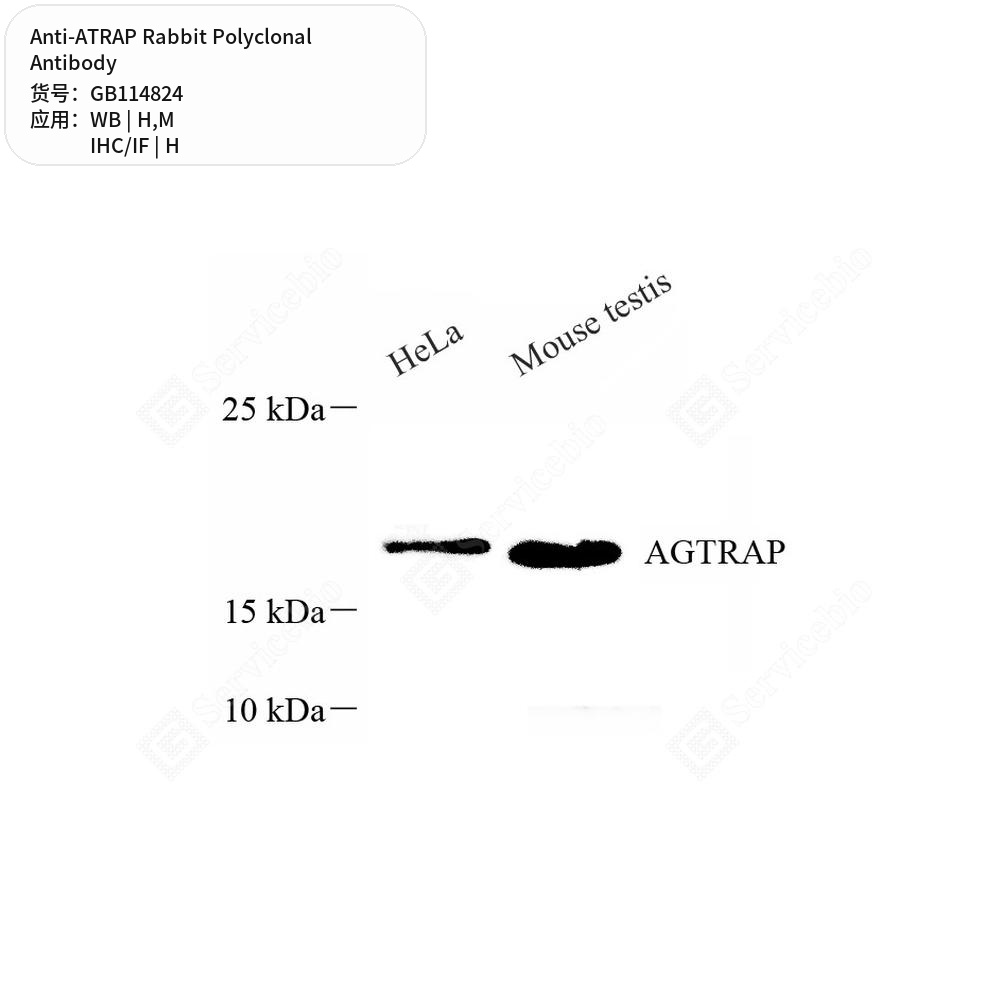 Антитела первичные, поликлональные кролика к ATRAP мыши, человека, 50 мкл